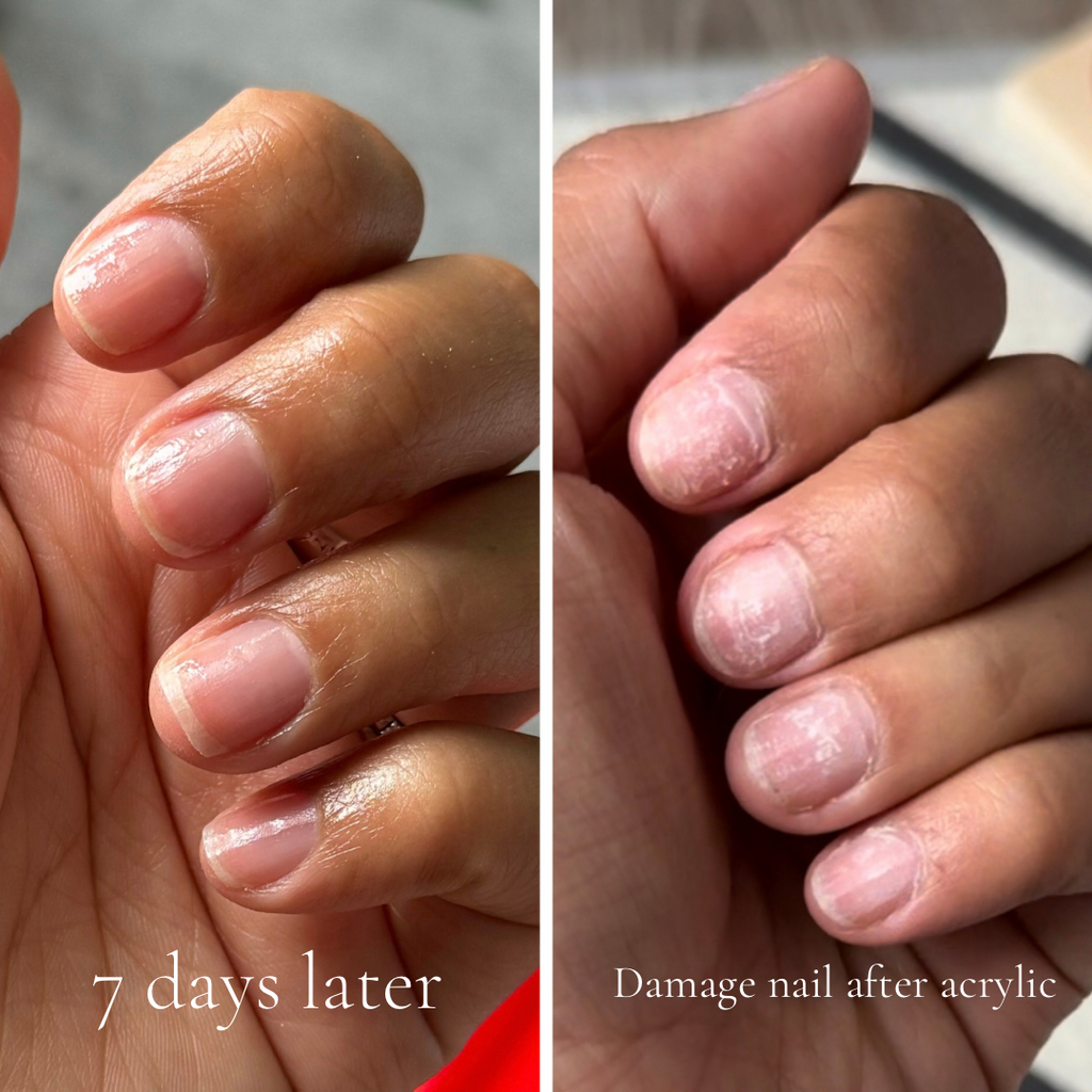 Natural Nail growth serum